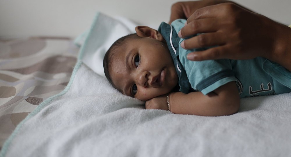 Casos confirmados de microcefalia en Brasil se disparan un 15% la última semana Casos confirmados de microcefalia en Brasil se disparan un 15% la última semana