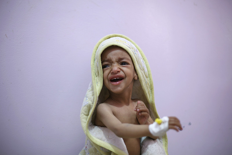 Niños famélicos en Yemen