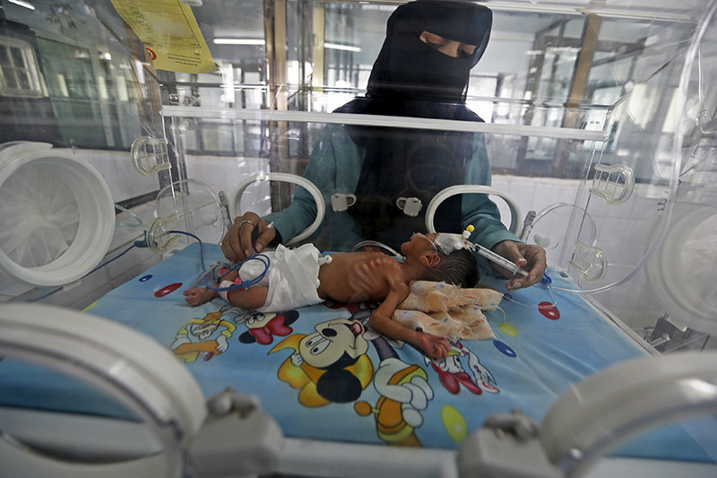 Niños famélicos en Yemen