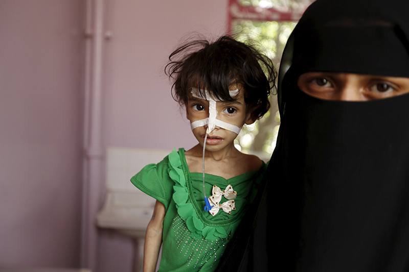 Niños famélicos en Yemen 