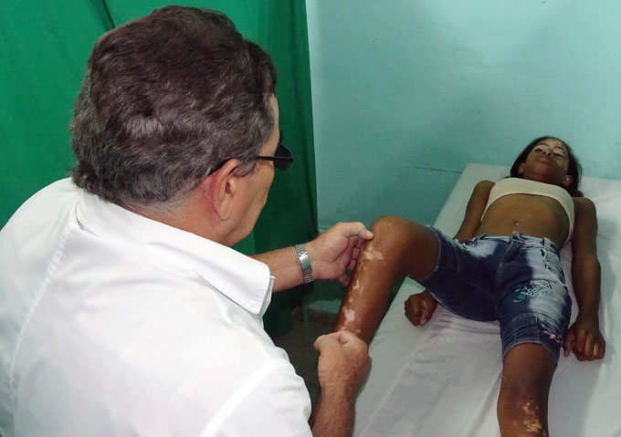 Diana Darlenis Vázquez Aguilar, de 13 años, aquejada de Vitiligo, es parte del Ensayo clínico, y ha recuperado ya el color en la frente y en parte del rostro.Foto: Luis Carlos Palacios Leyva.