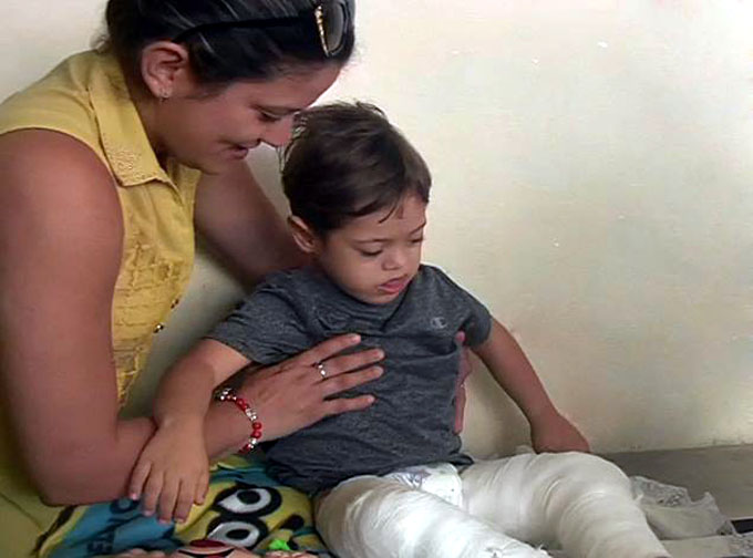 Evoluciona bien niño operado de luxación de rótula bilateral (+ fotos y video) Evoluciona bien niño operado de luxación de rótula bilateral (+ fotos y video)