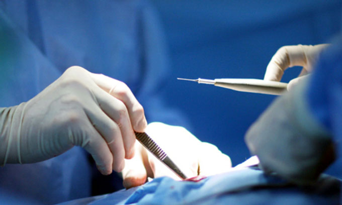 Realiza Cuba por primera vez cirugía de metástasis en peritoneo Realiza Cuba por primera vez cirugía de metástasis en peritoneo