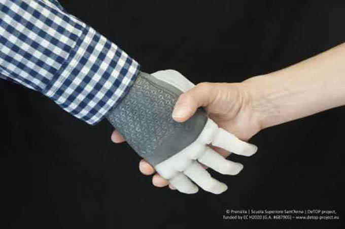 Realizan primer implante permanente en el mundo de una mano robótica Realizan primer implante permanente en el mundo de una mano robótica