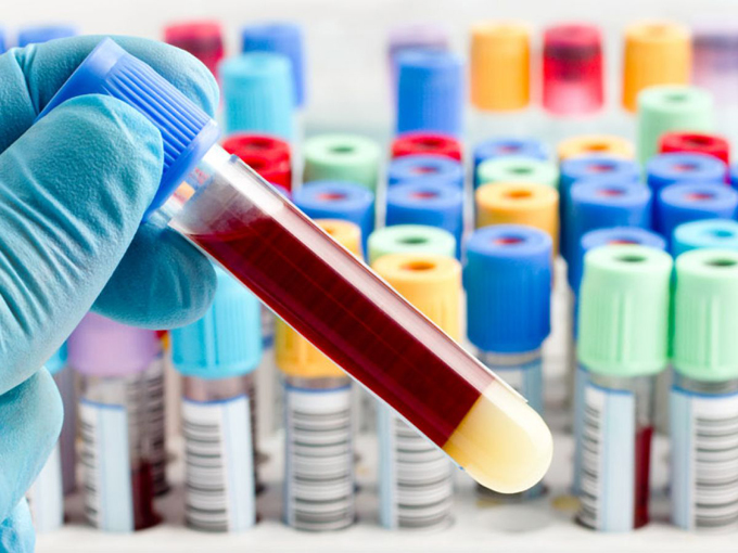 Test sanguíneo predice tuberculosis antes de los síntomas Test sanguíneo predice tuberculosis antes de los síntomas