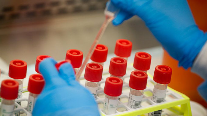 #ÚltimoMinuto: 56 casos confirmados, un fallecido, y 26 altas médicas de la Covid-19 en Cuba (+ video) #ÚltimoMinuto: 56 casos confirmados, un fallecido, y 26 altas médicas de la Covid-19 en Cuba (+ video)