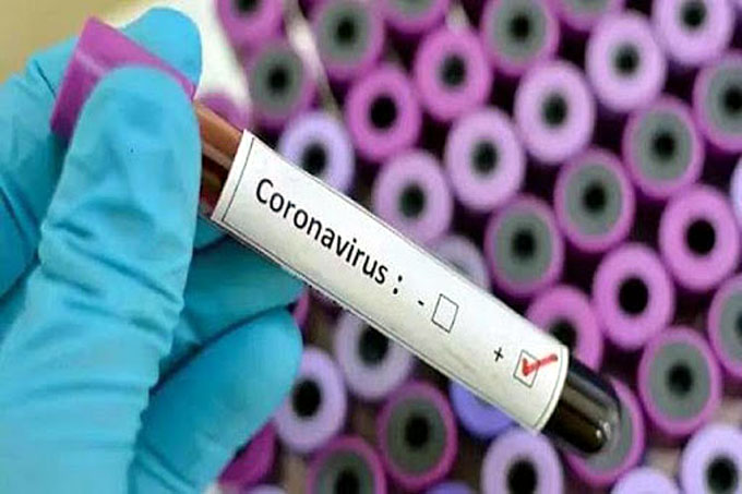 Confirman 61 nuevos casos positivos de la Covid-19, Cuba en fase de transmisión autóctona limitada (+ video) Confirman 61 nuevos casos positivos de la Covid-19, Cuba en fase de transmisión autóctona limitada (+ video)