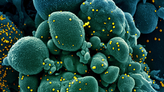 Científico ruso sugiere que el coronavirus “se quedará con nosotros para siempre” porque “no controlamos su propagación” (+video) Científico ruso sugiere que el coronavirus “se quedará con nosotros para siempre” porque “no controlamos su propagación” (+video)