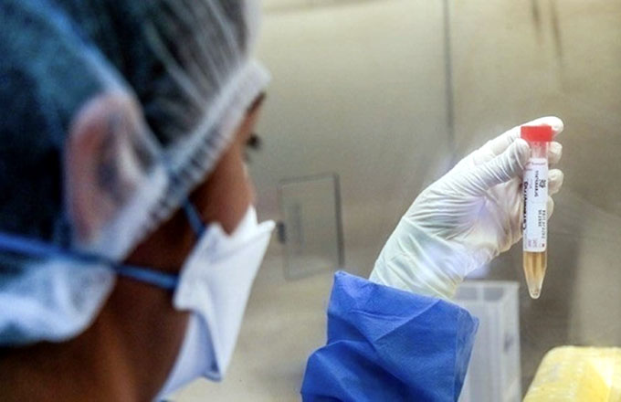 #ÚltimoMinuto: Cuba suma 38 nuevos casos de Covid-19 #ÚltimoMinuto: Cuba suma 38 nuevos casos de Covid-19