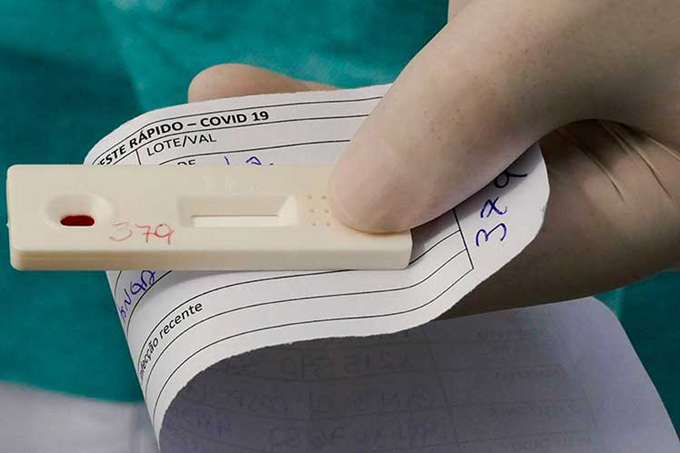 Brasil: millones de pruebas Covid-19 almacenadas por falta de insumos Brasil: millones de pruebas Covid-19 almacenadas por falta de insumos