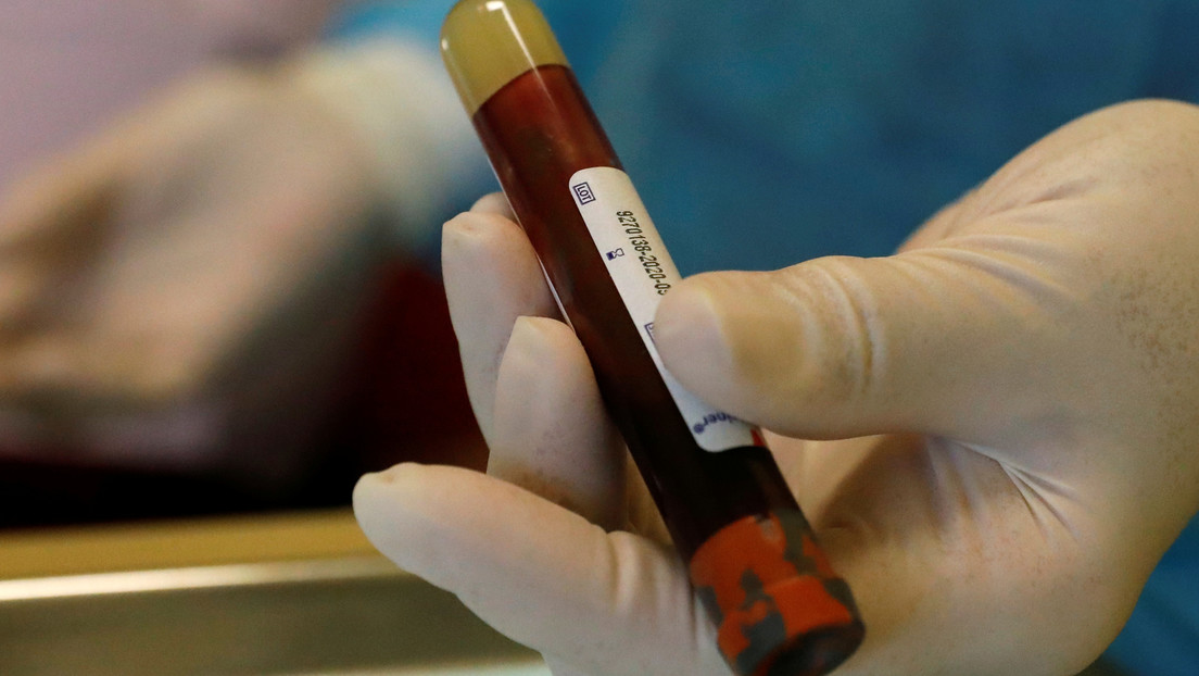 El nuevo hallazgo sobre cómo el coronavirus afecta a la sangre “agrega una pieza importante al rompecabezas del covid-19” El nuevo hallazgo sobre cómo el coronavirus afecta a la sangre “agrega una pieza importante al rompecabezas del covid-19”