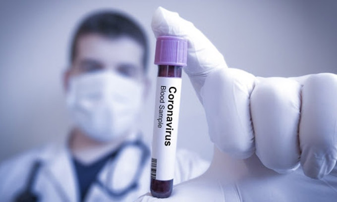 Cuba reporta 48 nuevos casos de Covid-19 y totaliza 5 mil 718 con esta enfermedad Cuba reporta 48 nuevos casos de Covid-19 y totaliza 5 mil 718 con esta enfermedad