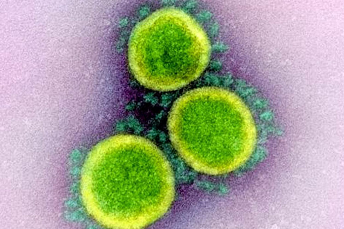 Descubren proteína clave para evitar replicación del virus SARS-CoV-2 Descubren proteína clave para evitar replicación del virus SARS-CoV-2