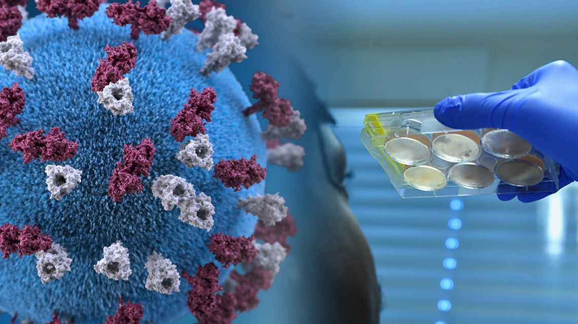 Covid-19, pandemia, nuevas cepas… en alerta la humanidad Covid-19, pandemia, nuevas cepas… en alerta la humanidad