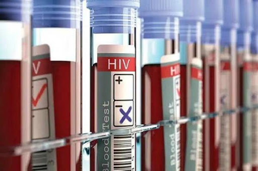 Mantiene Cuba control sobre la transmisión del VIH/Sida en el país Mantiene Cuba control sobre la transmisión del VIH/Sida en el país