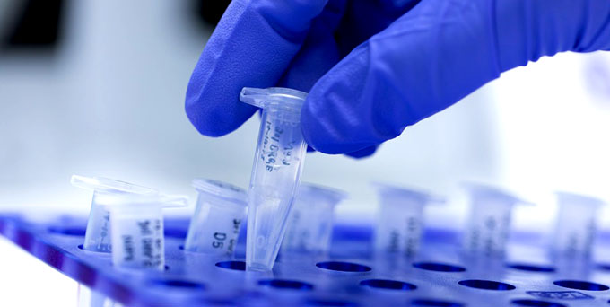 Procesará unos 400 PCR diarios laboratorio de Biología molecular de Granma (+ fotos) Procesará unos 400 PCR diarios laboratorio de Biología molecular de Granma (+ fotos)