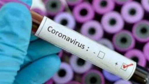 Cuba con 807 nuevos contagios de Covid-19 y tres fallecidos Cuba con 807 nuevos contagios de Covid-19 y tres fallecidos