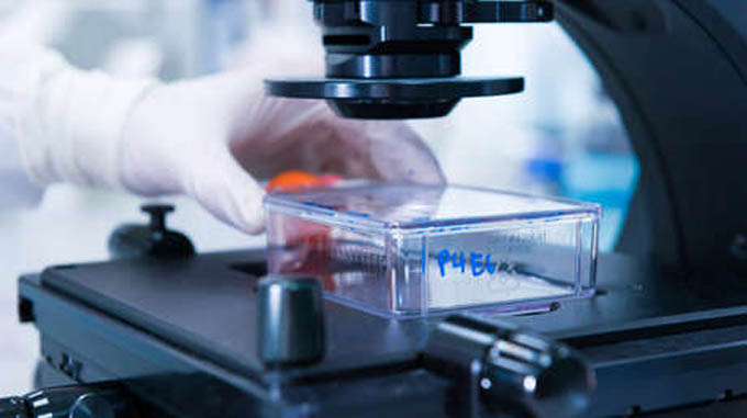 Una científica mexicana descubre la cura para eliminar al 100 % los virus del papiloma humano Una científica mexicana descubre la cura para eliminar al 100 % los virus del papiloma humano