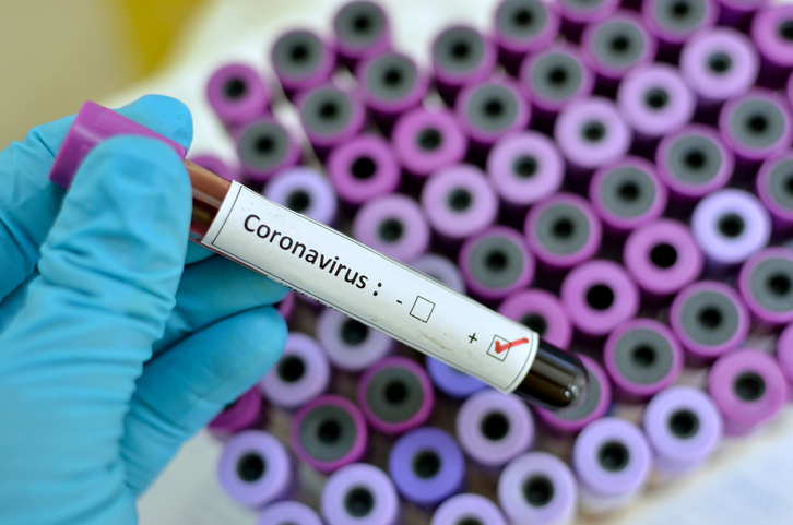 Registran el primer caso de la infección esporádica con COVID-19