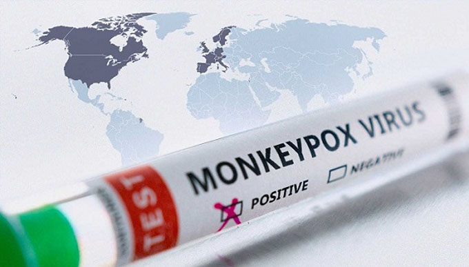 Europa registró más de 4 500 casos de viruela del mono durante las dos últimas semanas Europa registró más de 4 500 casos de viruela del mono durante las dos últimas semanas