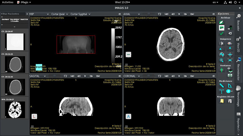 Imagis, un software al servicio de la salud pública Imagis, un software al servicio de la salud pública