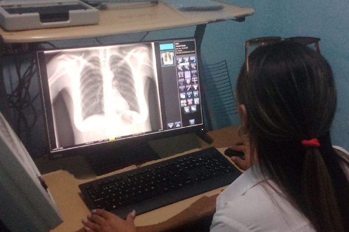 Funciona en Manzanillo moderno equipo de radiología digital Funciona en Manzanillo moderno equipo de radiología digital
