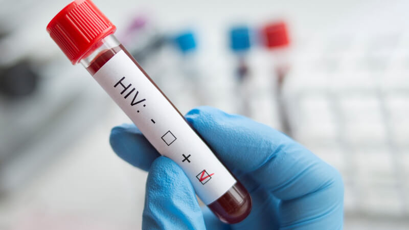 El sida podría dejar de ser amenaza para la salud en 2030 El sida podría dejar de ser amenaza para la salud en 2030