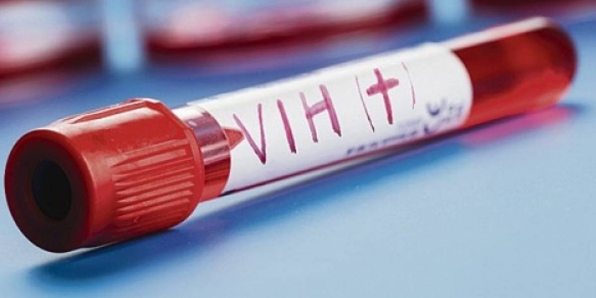 Detectan en Brasil nueva variante del VIH