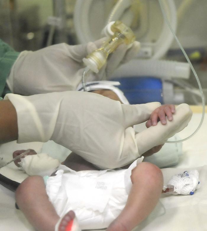 Centro de InmunoEnsayo inició la producción de nueva prueba para la pesquisa neonatal en Cuba Centro de InmunoEnsayo inició la producción de nueva prueba para la pesquisa neonatal en Cuba